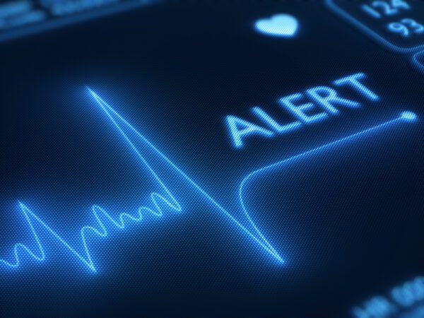 Alert on a heart monitor display